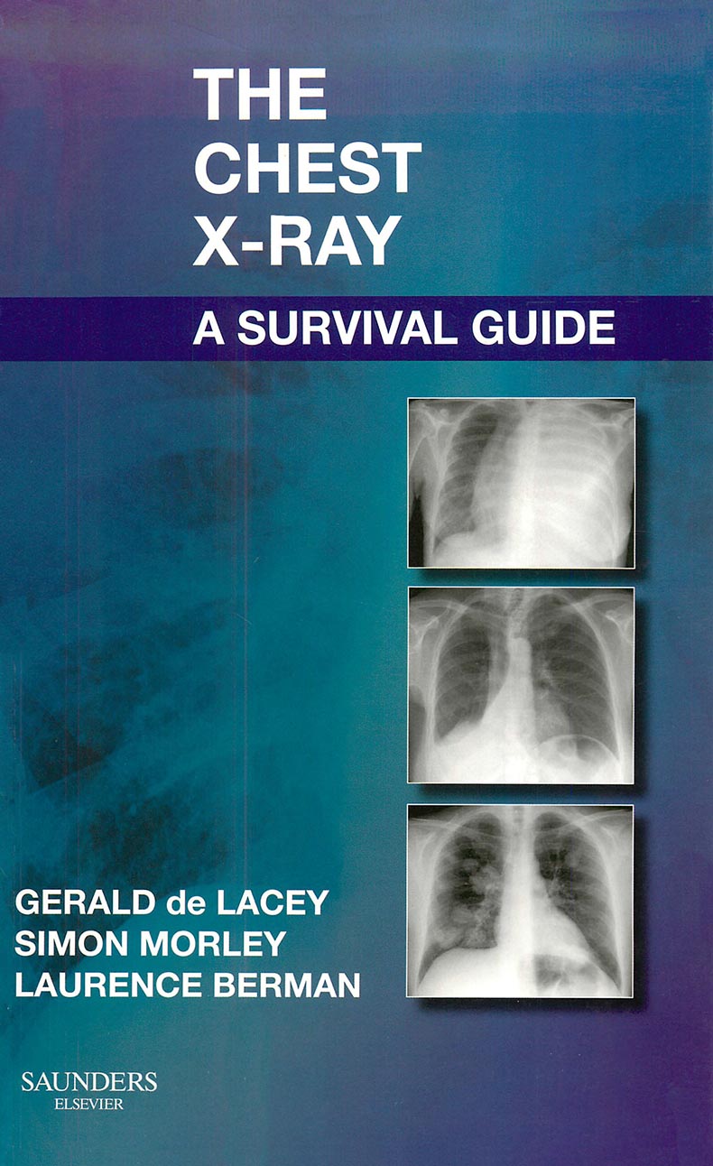 The Chest X-Ray - A Survival Guide - Gerald de Lacey